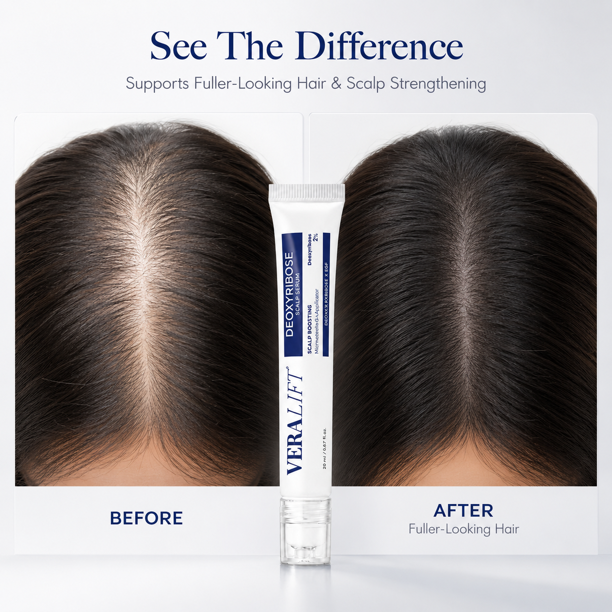 VeraLift™ Hair Revival Serum
